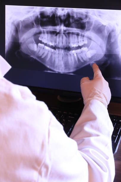 Best Dental Abscess Treatment in Perryville, AR